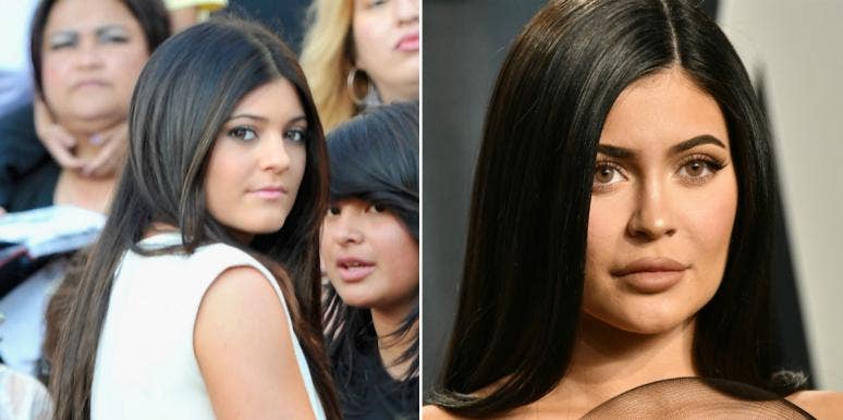 Did Kylie Jenner Have Plastic Surgery? Check Out These Before & After Photos — Where She Looks Like Beyonce!