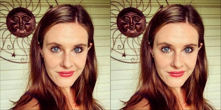 Forehead wrinkle Forehead wrinkle
