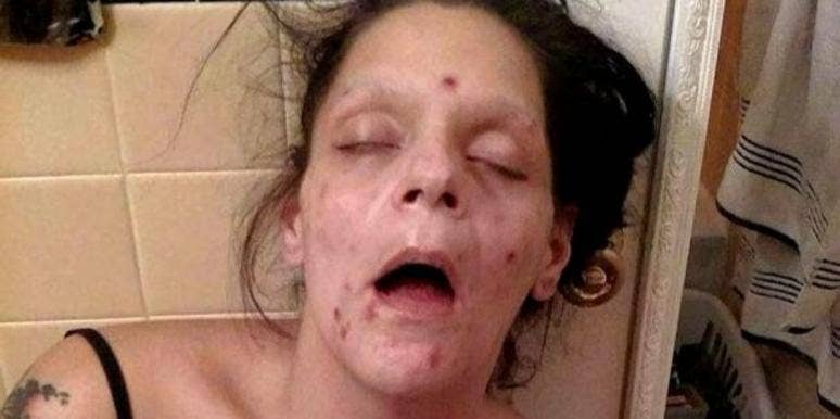 Recovering Addict Shares The Devastating Before And After Photos Of Drug Addiction recovering addict