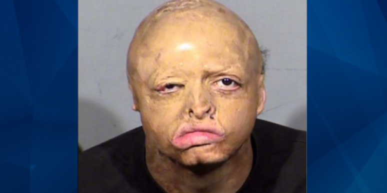 Michael MillerWho Is Michael Miller? New Details On Nevada Teen Disfigured In Fire Who Murdered Man Who Took Him Who Is Michael Miller? New Details On Nevada Teen Disfigured In Fire Who Murdered Man Who Took Him