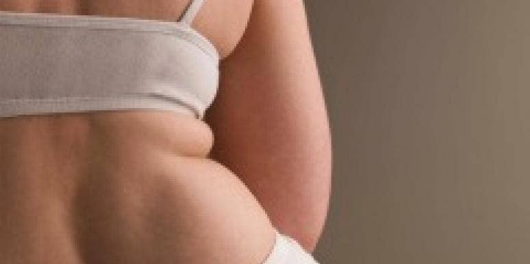 obese obese