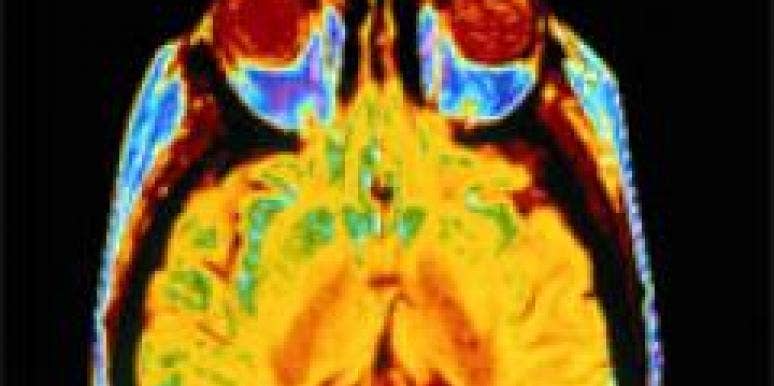 Sex Brain Chip Being Developed brain scan