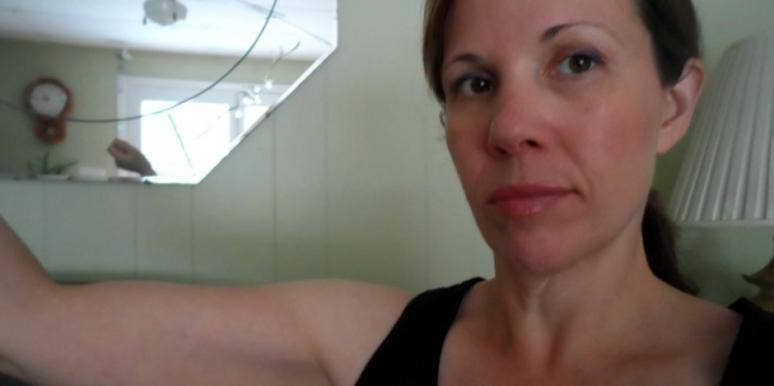 Why I Won't Have Excess Skin Removal Surgery Why I Won't Have Excess Skin Removal Surgery