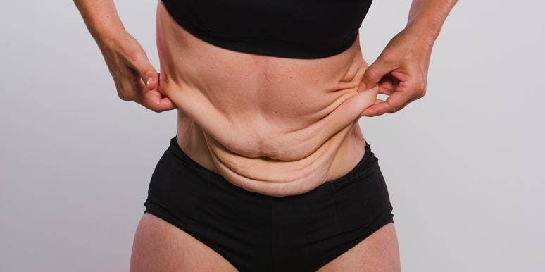 These Photos Show What Losing Weight REALLY Looks Like These Photos Show What Losing Weight REALLY Looks Like