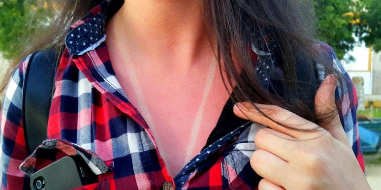 How to know if you have sun poisoning (and what to do about it)