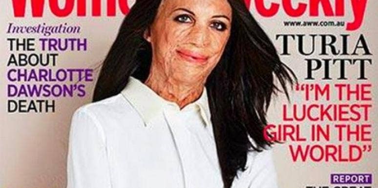 Turia Pitt turia-pitt