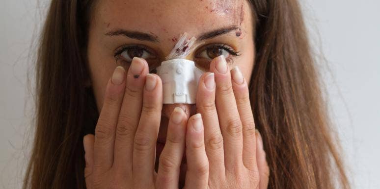 What Accidentally Breaking A Girl’s Nose Taught Me About Being Cool broken nose