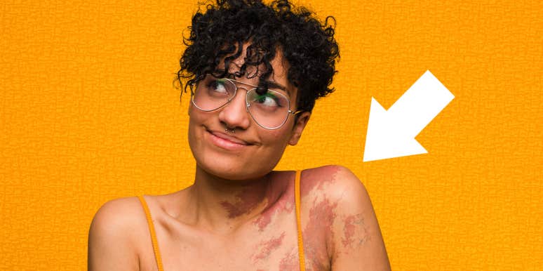 What It Means If You Have No Birthmarks smiling woman