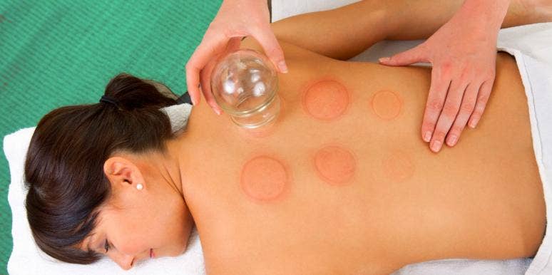What Is Cupping & What Are The Benefits? + 12 Products To Use At Home What Is Cupping & What Are The Benefits? + 12 Products To Use At Home