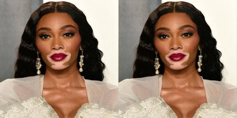 Who Is Winnie Harlow? 5 Inspiring Details About Wiz Khalifa's New Girlfriend Who Is Winnie Harlow? 5 Inspiring Details About Wiz Khalifa's New Girlfriend