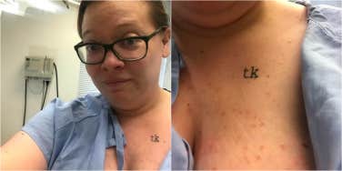 woman-author of article with psoriasis 