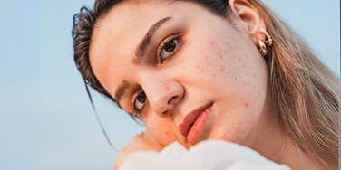 Woman experiencing surprising changes in appearance, due to hormones.