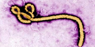 ebola virus