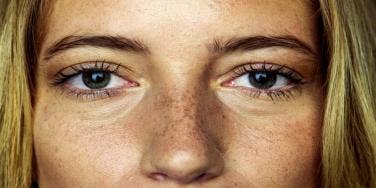 woman freckled face