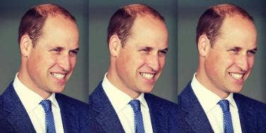 Prince William bald haircut photos