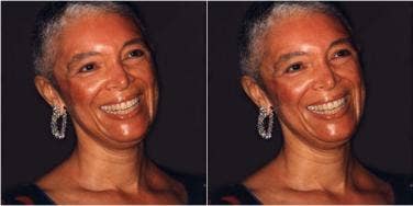Camille Cosby