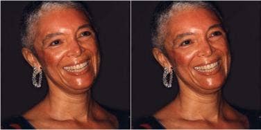 Camille Cosby