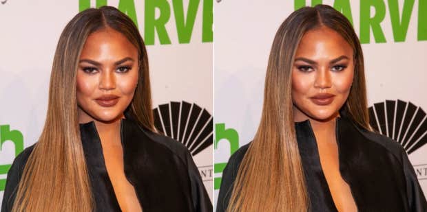 Chrissy Teigen Offers A Brutally Honest Response To People Criticizing Her 'New Face' - Vimarsana News