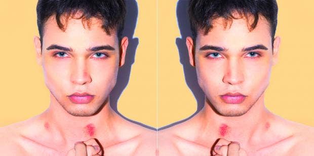 Are Hickeys Dangerous? The Truth About Love Bites | Yourtango
