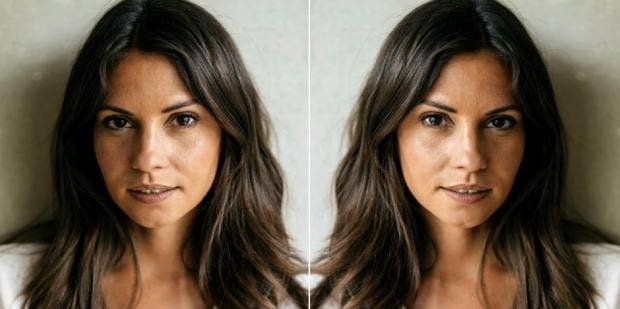 7 problematic collagen side effects