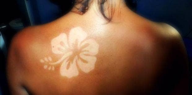People Turning Their Sunburn Into Body Art Because America Yourtango