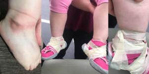 Jessica Hayes' daughter's shoes taped by daycare workers