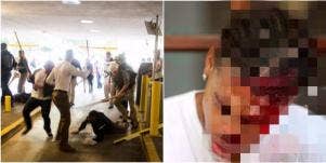 Video Of Charlottesville Man Beaten By White Supremacists As Police Stand Watch In Silence
