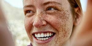 woman with freckles smiling wide showing teeth