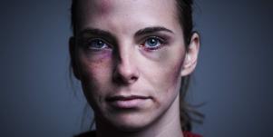 My Ex-Husband Is What Happened To My Face (You Can Stop Staring)