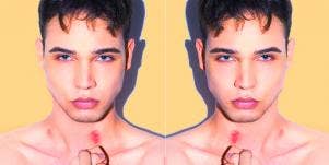 Are Hickeys Dangerous? 