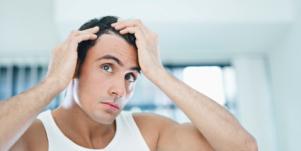 man balding