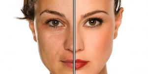 woman's face before and after photoshop
