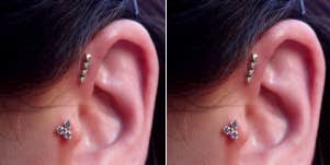 helix piercing