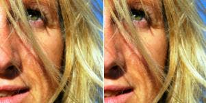 depression and anger 3 ways to cope