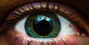 eye with a dilated pupil