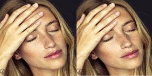 woman with hand on face