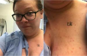 woman-author of article with psoriasis 