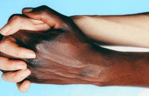 Interracial Dating Interracial Dating