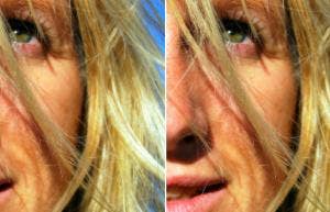 single women over 40